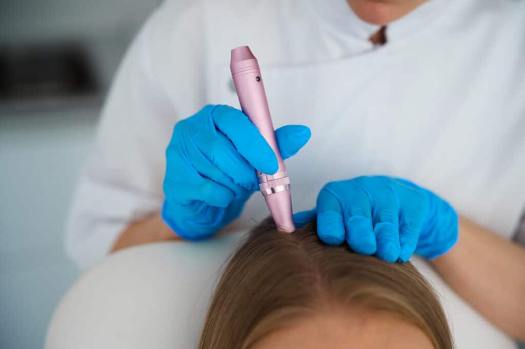 PRP Hair Treatment in Malaysia: All You Need to Know 2 professional scalp treatment using a microneedling 2026 08 14 15 25 23 utc 1